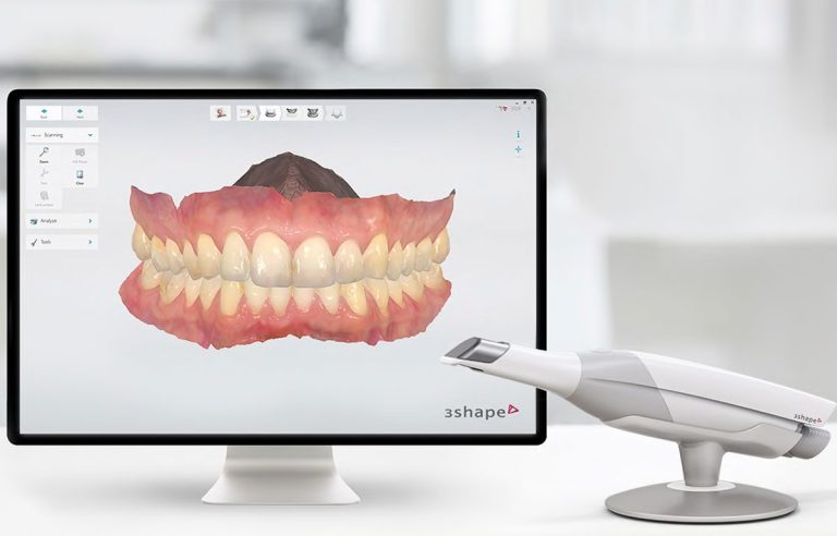 Escáner intraoral utilizado para diagnóstico digital